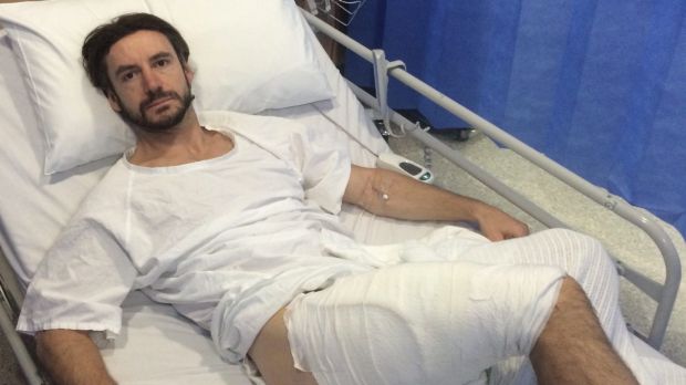 Gareth Clear sai jalkaansa pahan palovamman, kun vaurioitunut akku kuumeni äkillisesti.