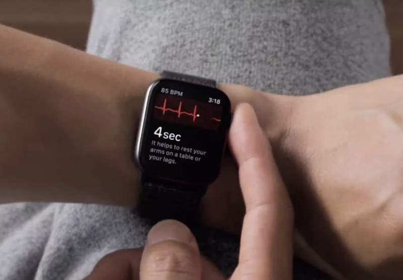 Apple Watch Toimii Nyt EKG mittarina My s Suomessa Mobiili fi