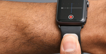 AliveCor tuo edistyneen sykemittarirannekkeensa Apple Watchille.