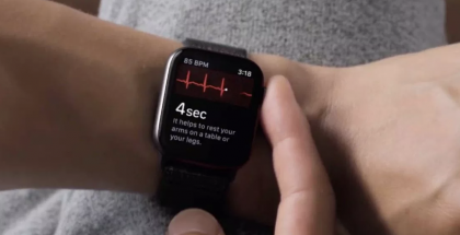 EKG-mittaus Apple Watchissa.