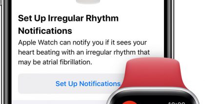 Apple Watch osaa varoittaa epäsäännöllisestä rytmistä, joka voi kieliä eteisvärinästä.
