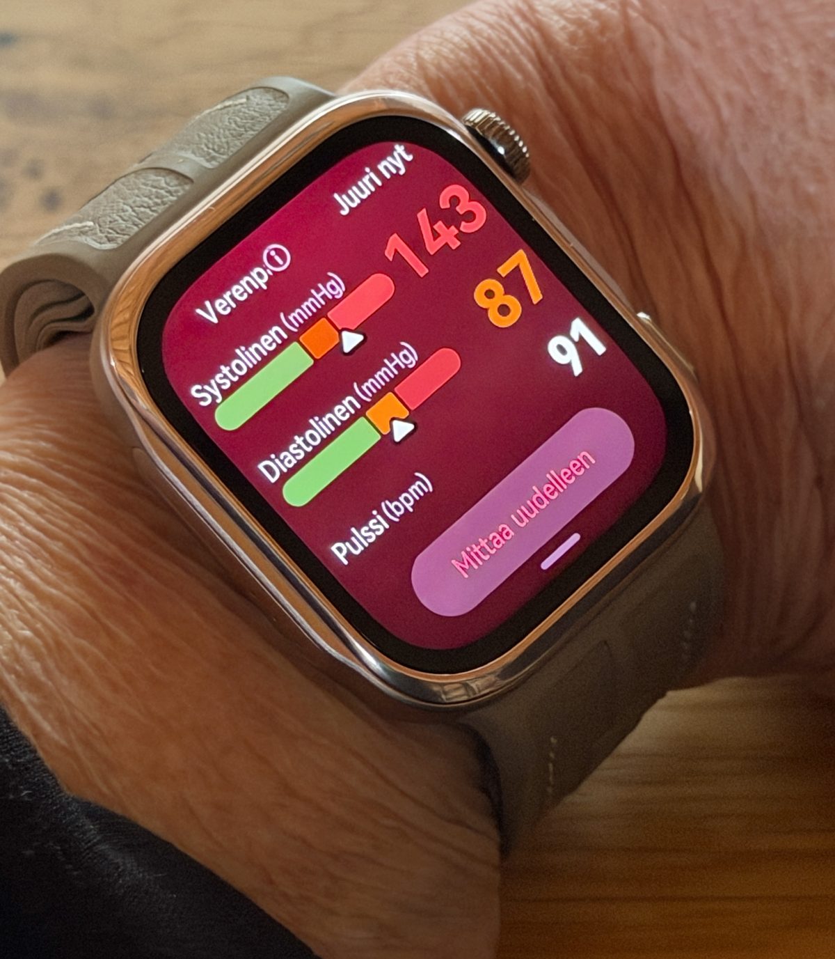 Jos verenpaine on korkea, kertoo Huawei Watch D3 siitä selvästi myös punaisella taustavärillä.