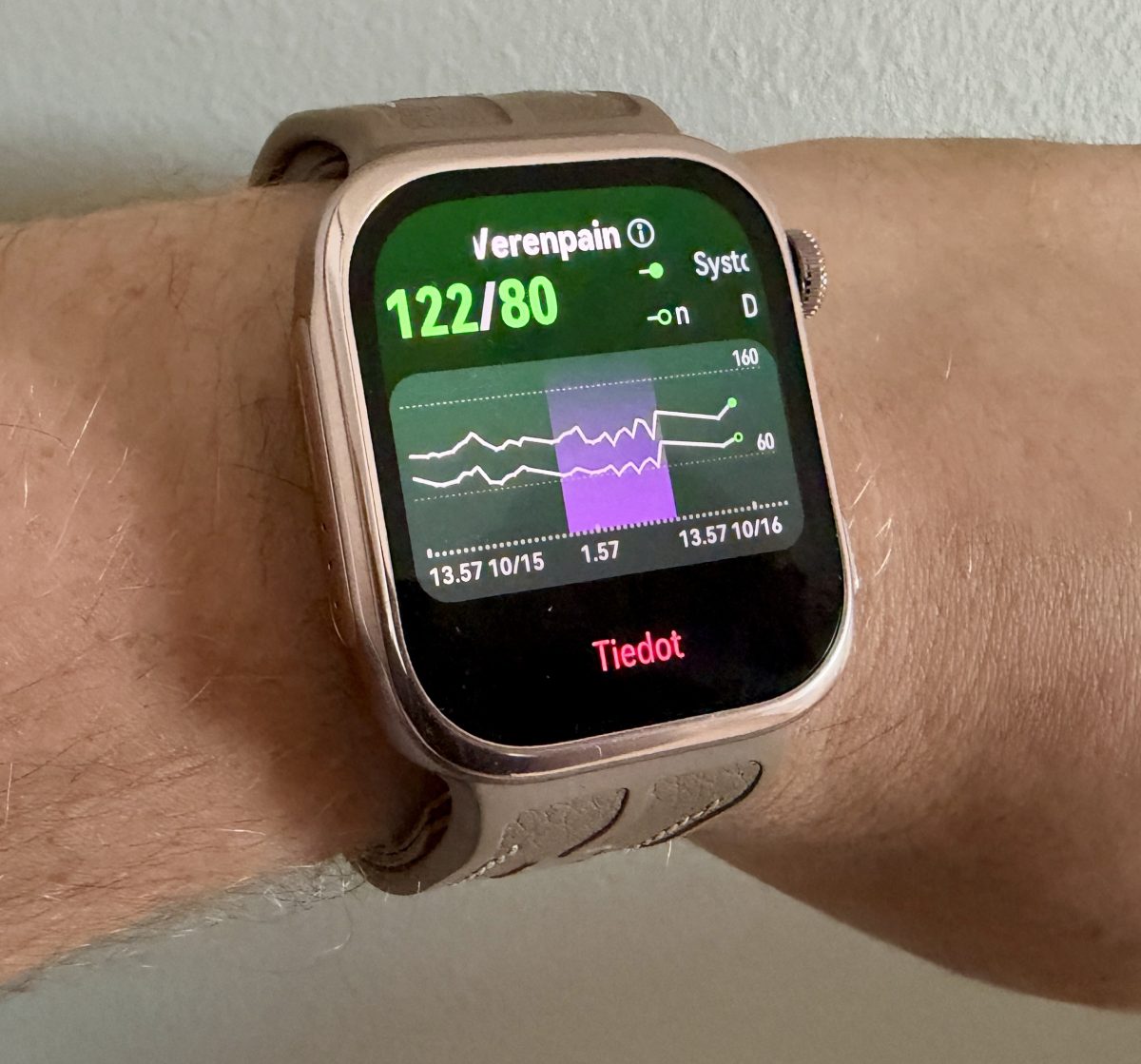 Huawei Watch D3 erottuu verenpaineen mittauksella kaikista muista älykelloista.