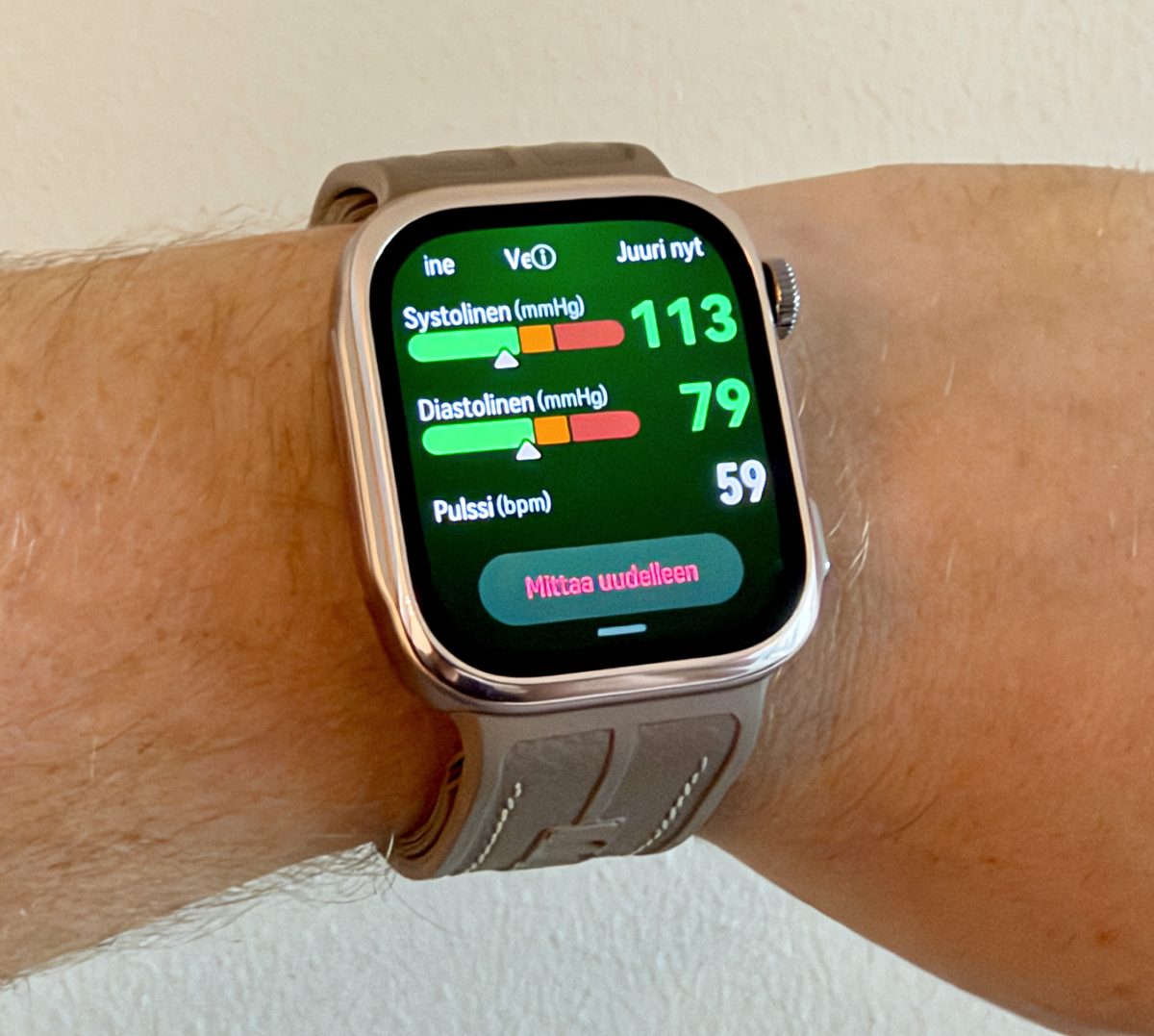 Verenpaineen mittaus Huawei Watch D3:lla on helppoa.